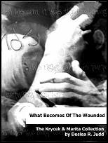 What Becomes Of The Wounded: The Krycek/Marita Collection